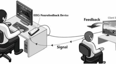 Akcija nabavke NEUROFEEDBACK uređaja